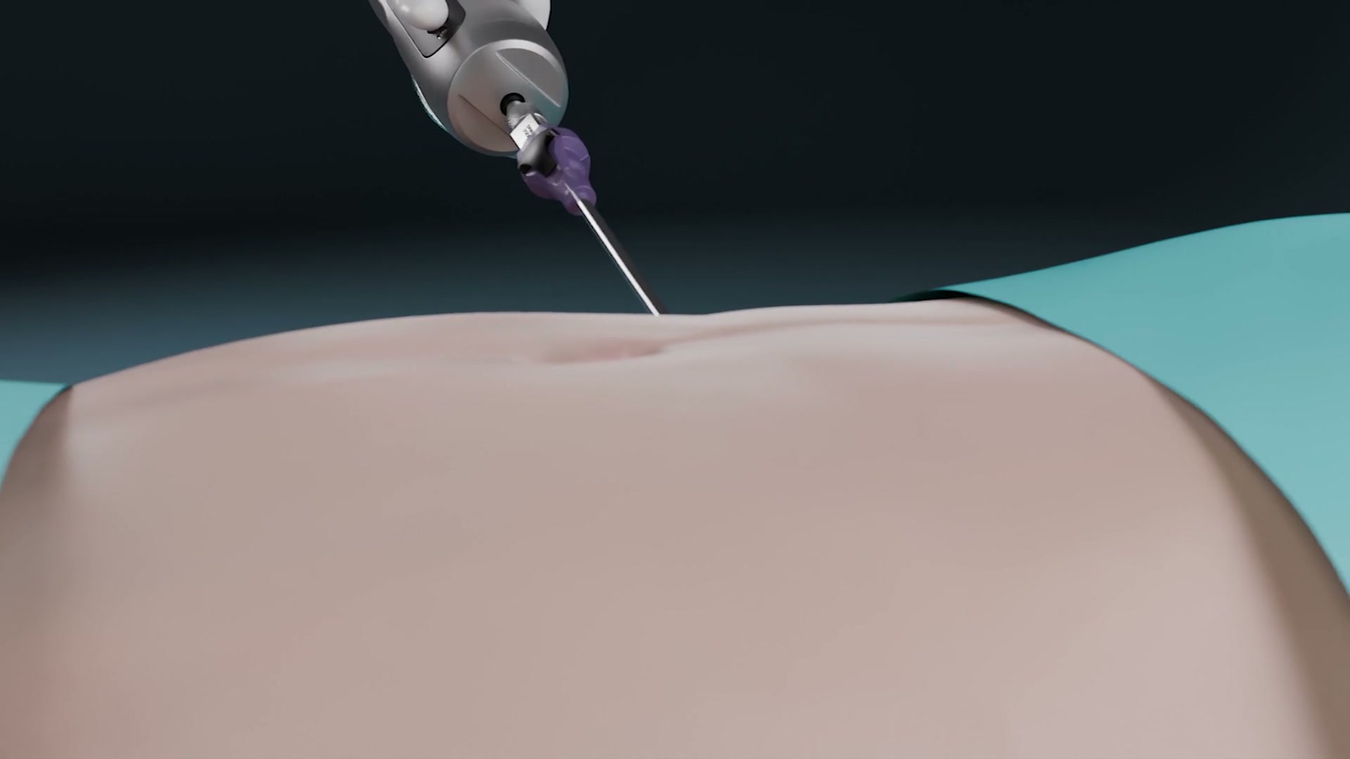 3D-Rendering Möller ThermoLys Pro Probe Medizininstrument